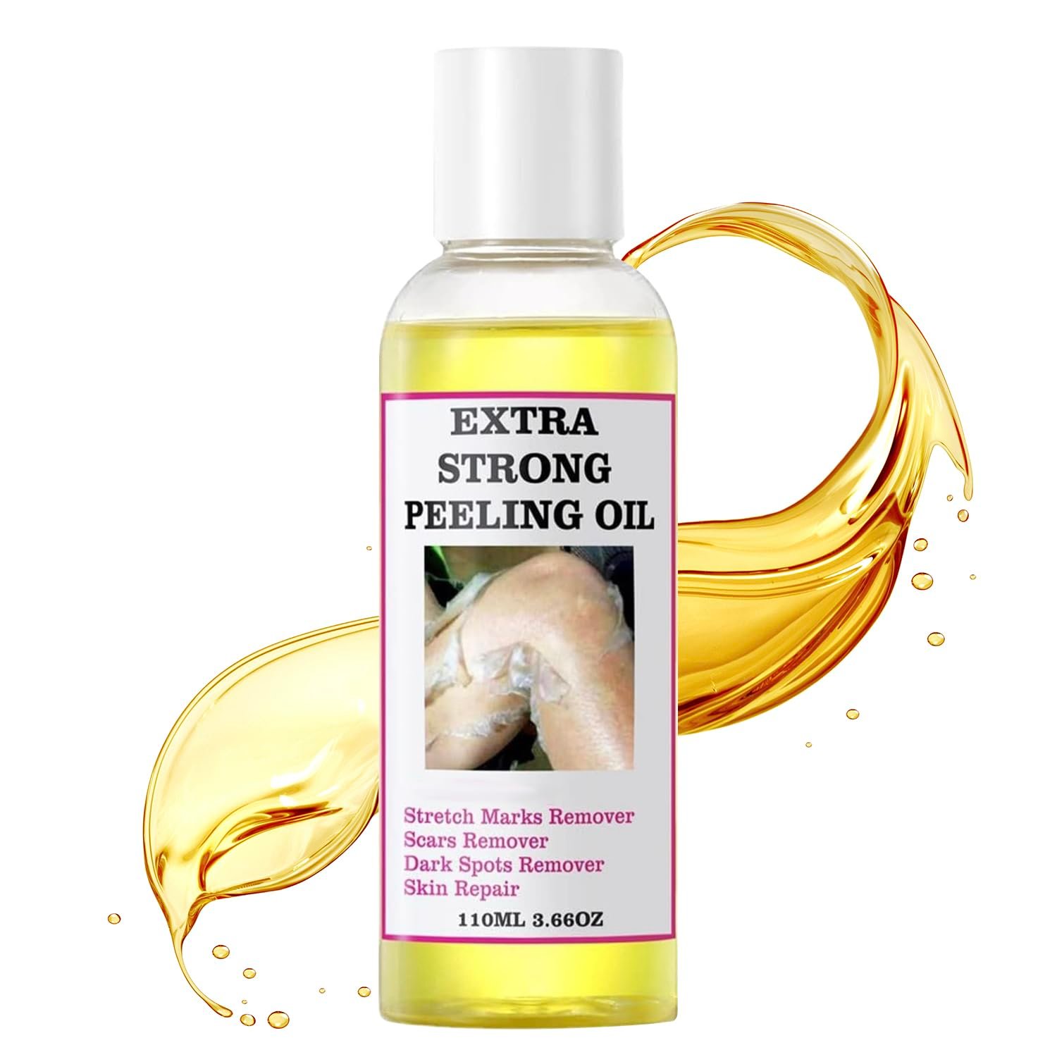 Chemical Peel for Face – Peeling Oil for Facial & Body Exfolianting with 16% Salicylic Acid – Dead Skin Remover with Gentle Formula for All Skin Type – 110mL(3.66OZ)